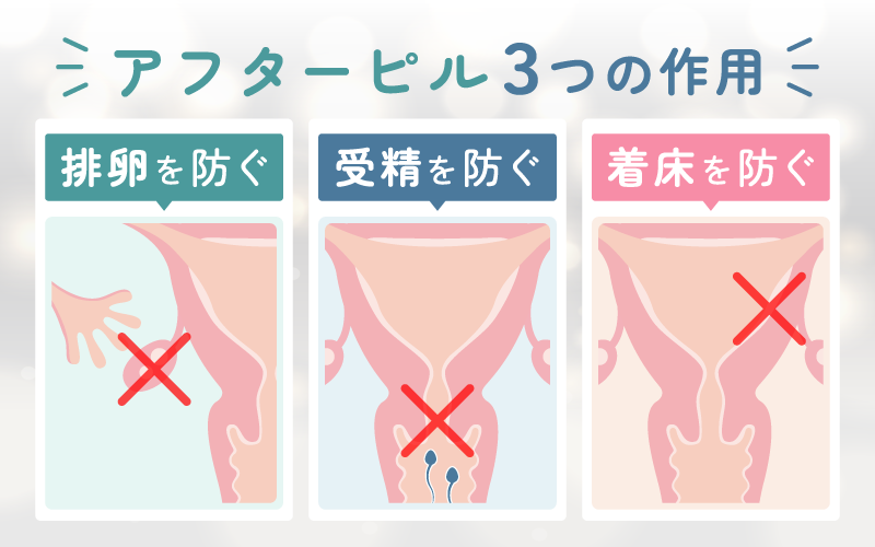 アフターピルの3つの作用